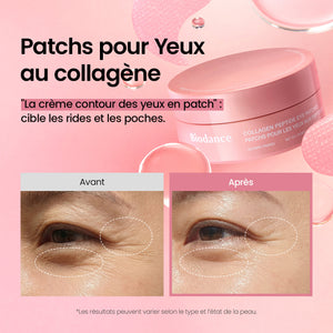 Patchs hydrogel Biodance au collagène avec résultat avant et après sur les ridules et les poches sous les yeux.