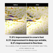 Résultats avant / après contour des yeux montrant une amélioration visible des rides, ridules et pattes d’oie après une routine skincare anti-âge hydratante.